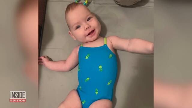 Baby and Dad Survive Rare Brain Surgery