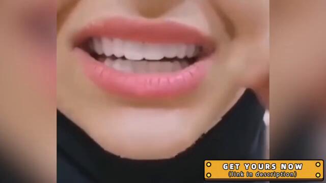 Snap On Smile 2021 Review, Magic Smart Smile Veneers Review 2020, Does It Work !