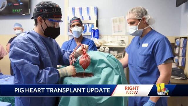 Statement imparts new info in pig heart transplant patient's death
