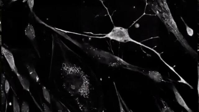 budding thinking glands