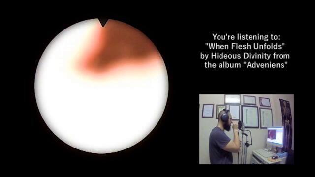HIDEOUS DIVINITY (ENRICO DI LORENZO) - WHEN FLESH UNFOLDS (OFFICIAL VOCALS PLAYTHROUGH) [THROAT CAM]
