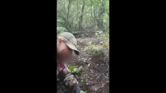 His jaw was blown off. Canadian surgeons helped rebuild it