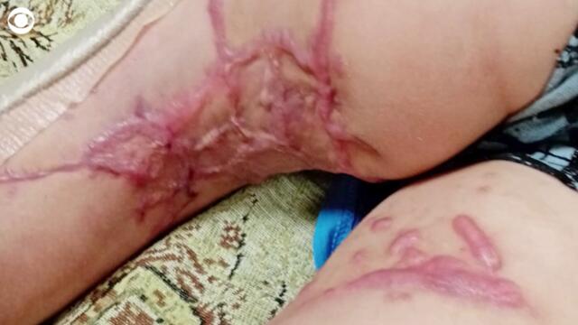 Three kidnapped Ukrainian children recount being taken by Russian soldiers