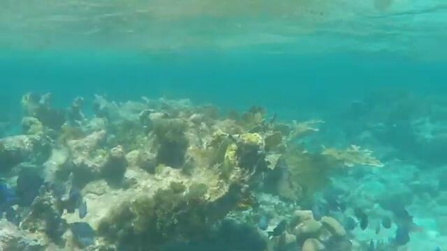 Shark Attack Survivor Wins Paralympic Swim Medals