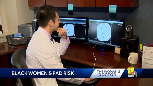 Black women more likely to develop PAD