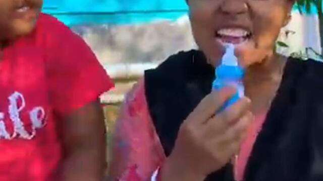 Missing Teeth Because of squid Games?🦷🤣😂#shorts #viral #trending #funny