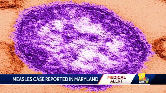 Confirmed case of measles in Howard County, Maryland